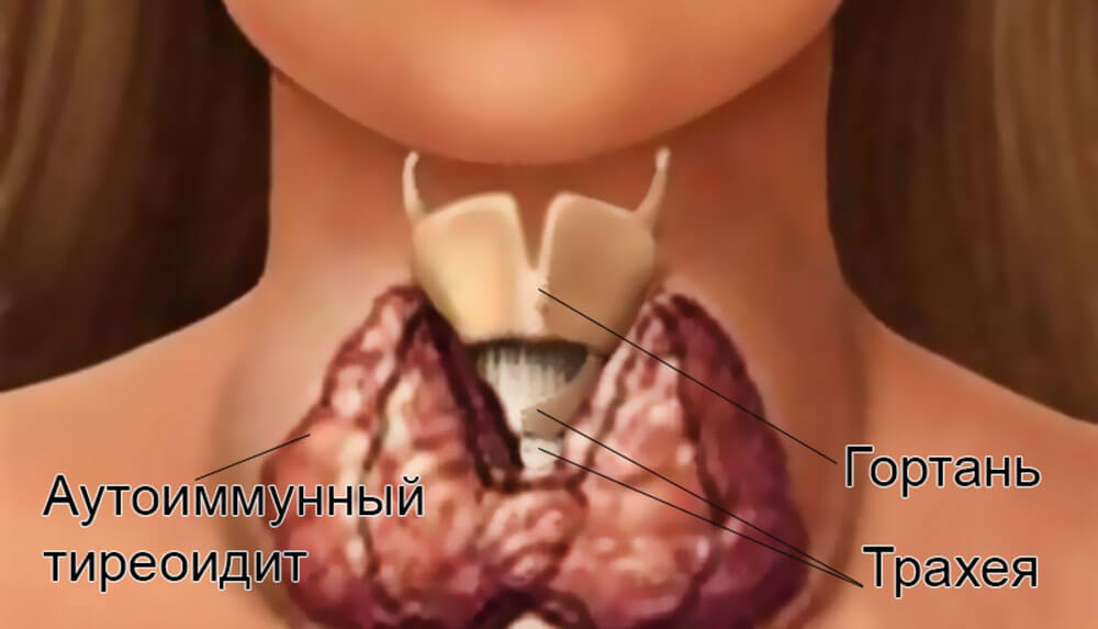 болит шея сзади / почему болит шея сзади